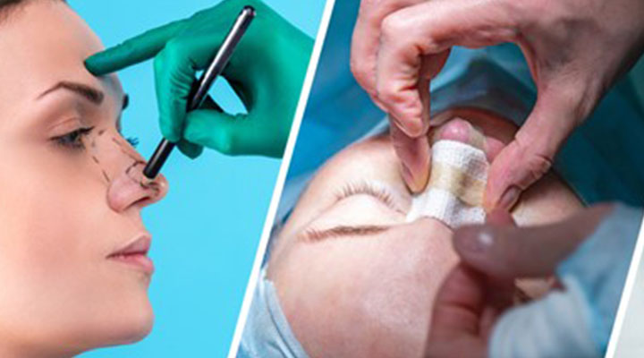 Rhinoplasty Symposium
